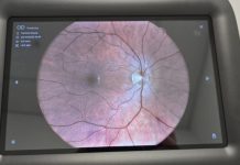 Pilot-projekat teleoftalmologije – brža i dostupnija zaštita vida