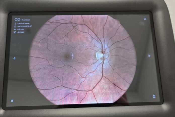 Teleoftalmoloski nalaz, decembar 2025